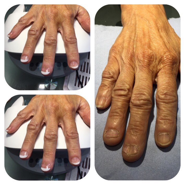 ExclusivelyMe88's tweet photo. Such a tough job but what a great result 👌#nails https://t.co/f3RiN9XZNR