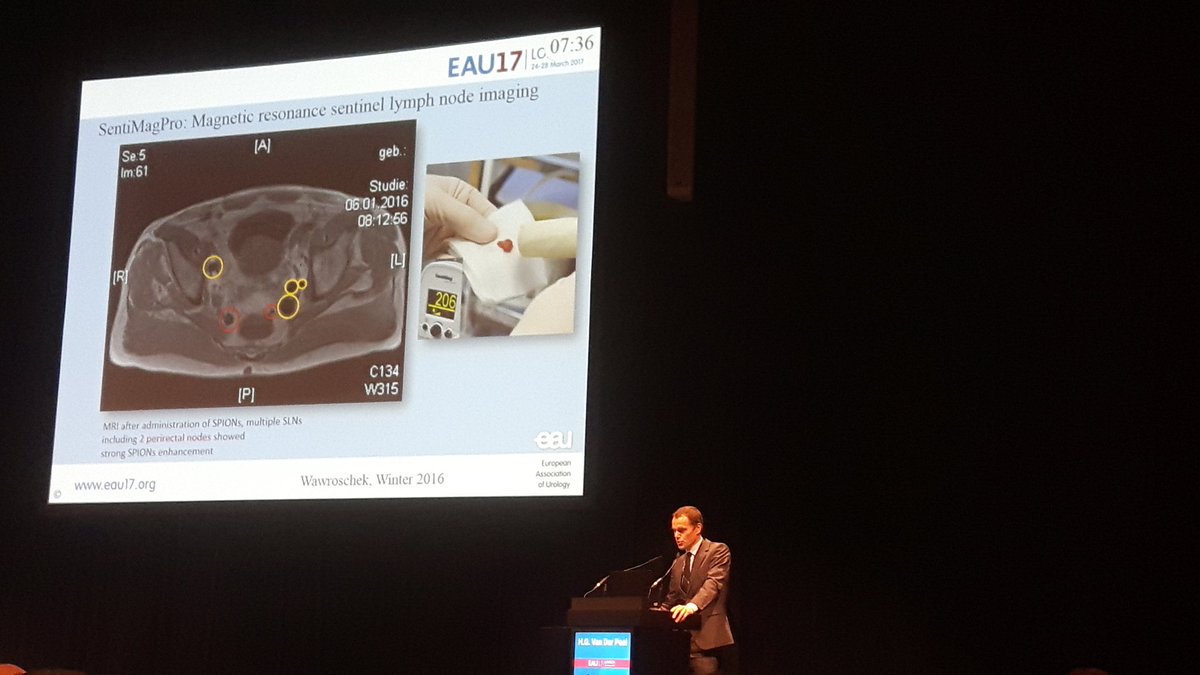 anwuyts's tweet photo. #Sentimag presented during #EAU17 #prostatecancer #sentinellymphnode #nonradioactive #tracer #openRP #boothE40 #SysmexEurope #SysmexBNL https://t.co/LK3WFCxbzX