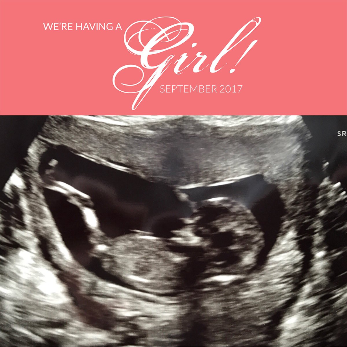 skippy_bee's tweet photo. We're having a GIRL! 🎀 #soexcited #babygirl #dueSeptember #babynumber3 #blessed https://t.co/hbzr3uCbtH