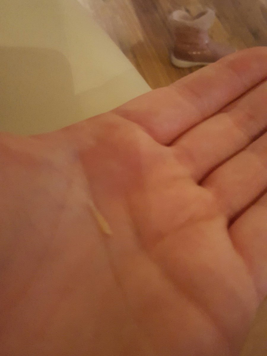 welshwill's tweet photo. @coopukfood found this fingernail in my apple pie!! 😫😨😱 #feelsick #donteatatcoop https://t.co/GTjHrl27G5