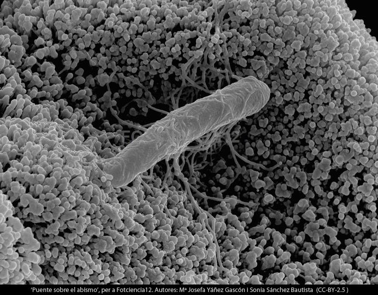 #mésquemil Fotografia on es veu un bacil de la flora bacteriana sobre l'epiteli de l'intestí gros #Fotciencia #prevencioncancercolon