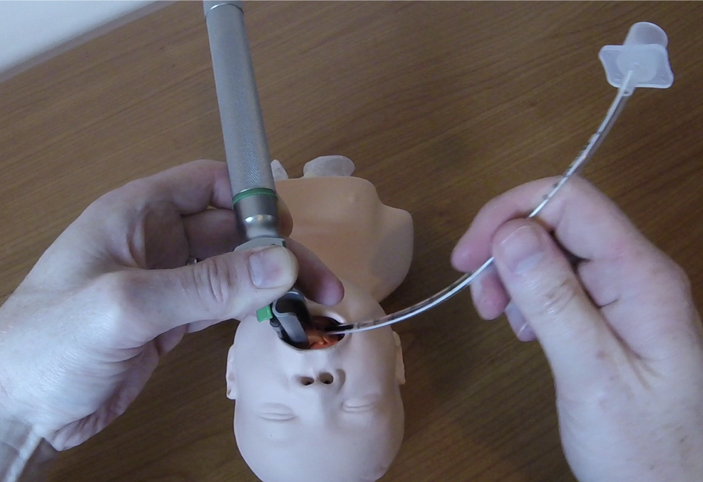 PaedEmergencies's tweet image. A step by step approach on how to succeed with direct laryngoscopy in children
paediatricemergencies.com/index.php/2017… 
#FOAMpeds