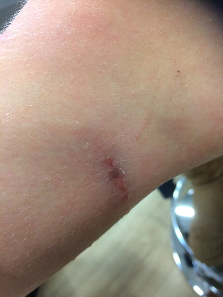 thomassouthern's tweet photo. @curryspcworld not a very good experience at aintree my daughter sits on a cheap display bench and gets a nasty pinch on her leg https://t.co/iOppoBKPEJ