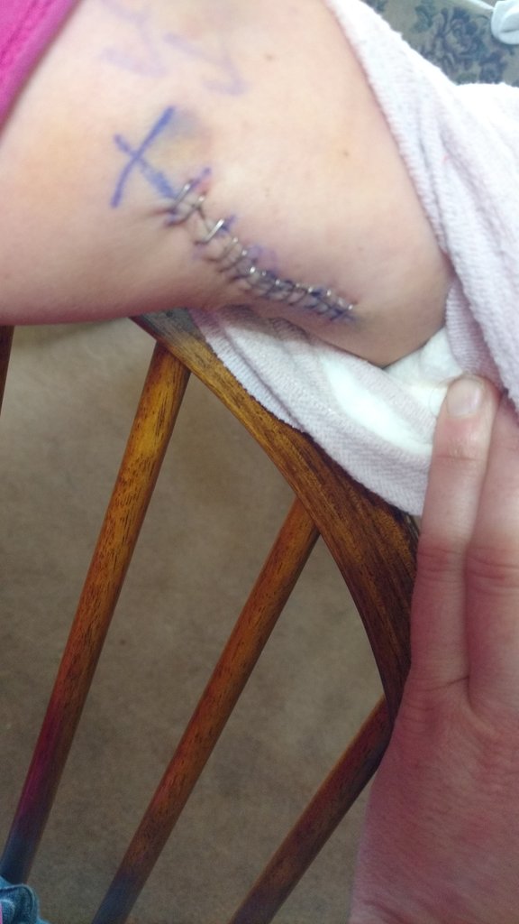 This has been causing me so much pain this past week