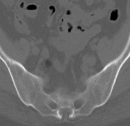 MSK_muse's tweet photo. Illusions in radiology - AS - I too enjoy them - @morrisonMSK https://t.co/TOQB4E4CWn