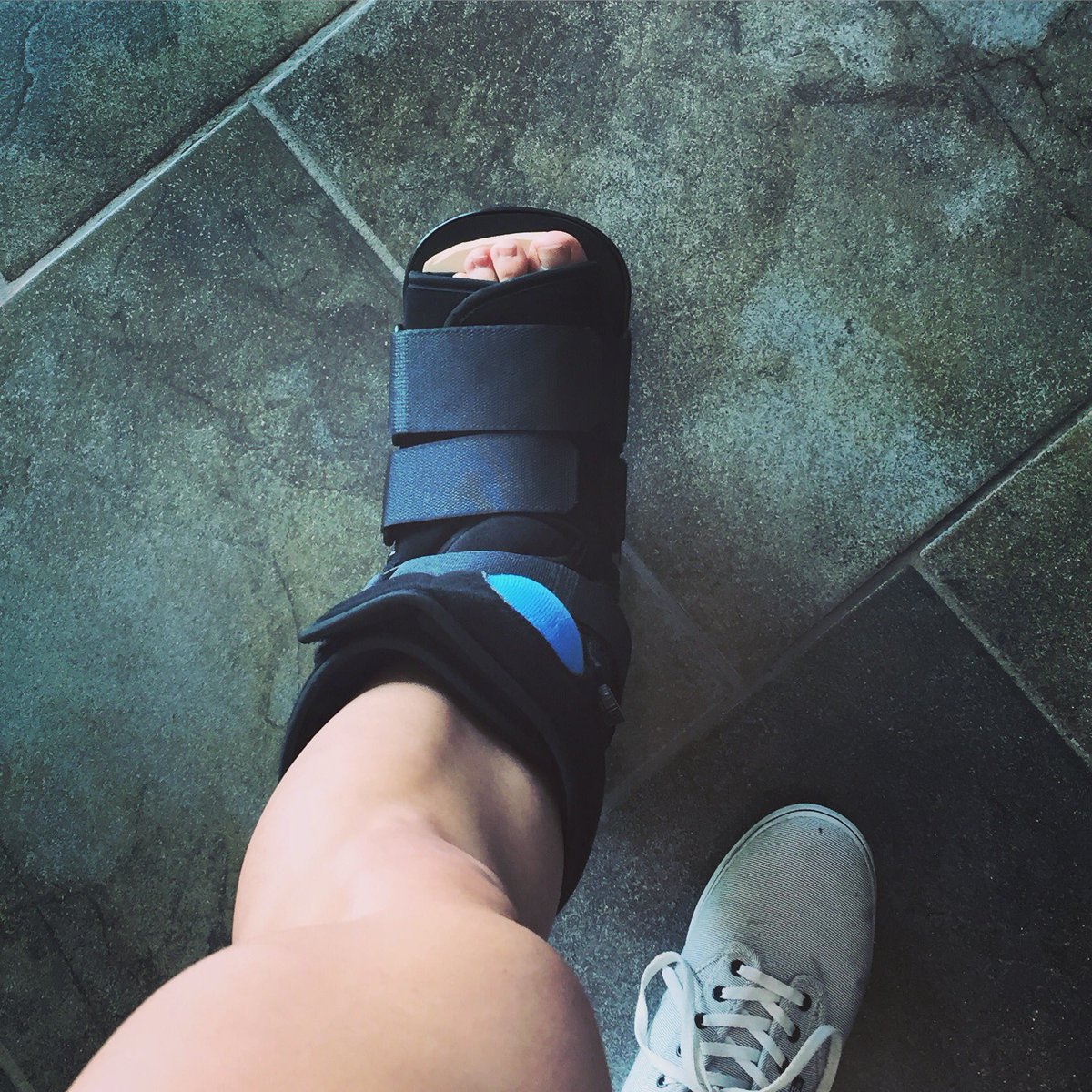 jenn_bessette's tweet photo. Decided to learn more about #AZPod today but from a firsthand perspective #nofracture #bootlife #onlytwoweeks #podiatry https://t.co/PIVvHweA9o