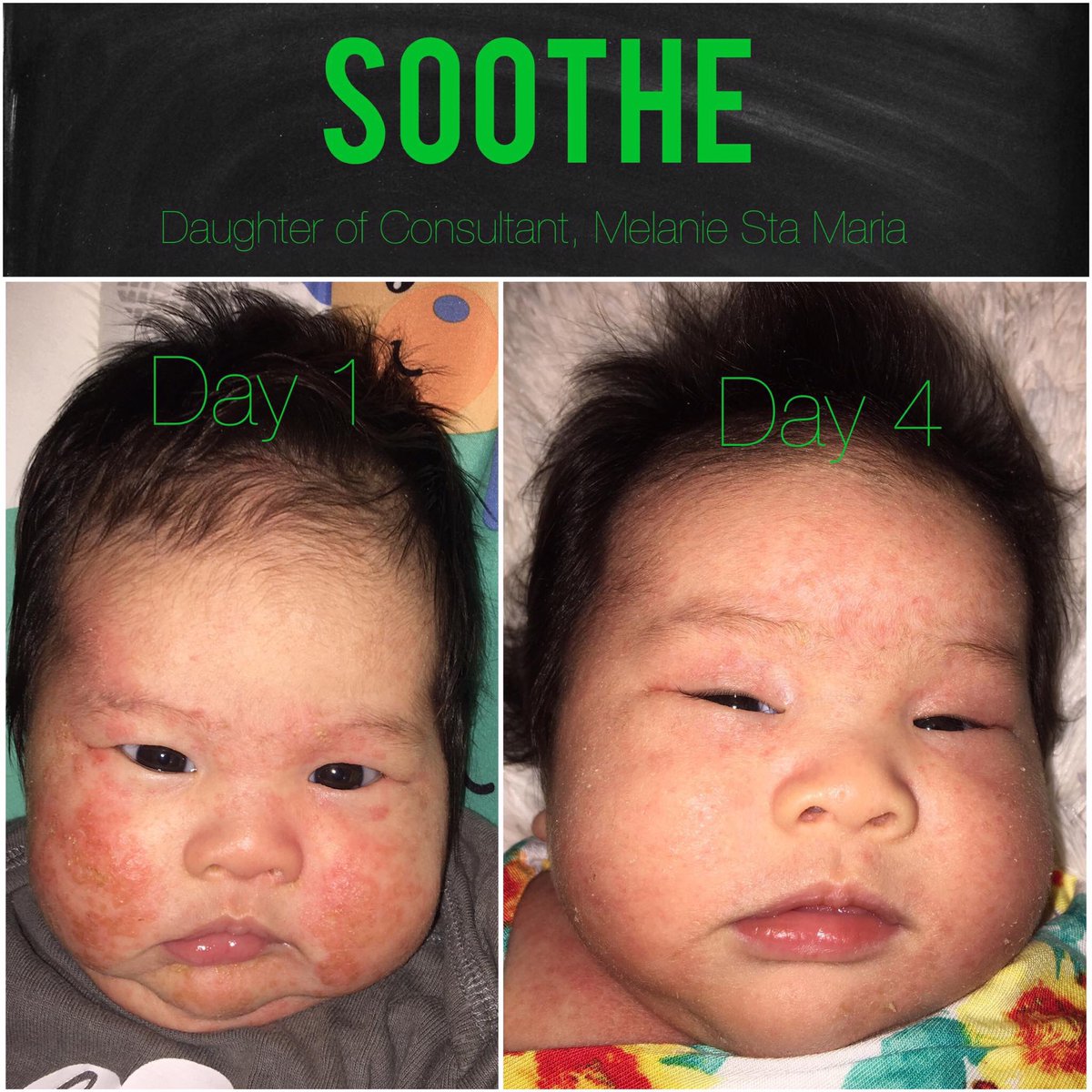 KSMALLZIE's tweet photo. Best skincare, Rodan and Fields. No more rash! #firstaid #baby #momlife #rash #skin #skincare https://t.co/c1hKswgc4x