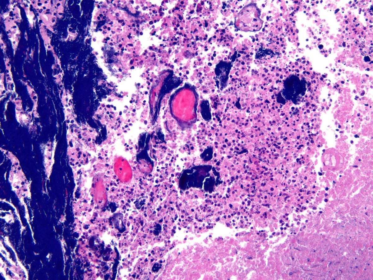 Sanjay Mukhopadhyay tweet media