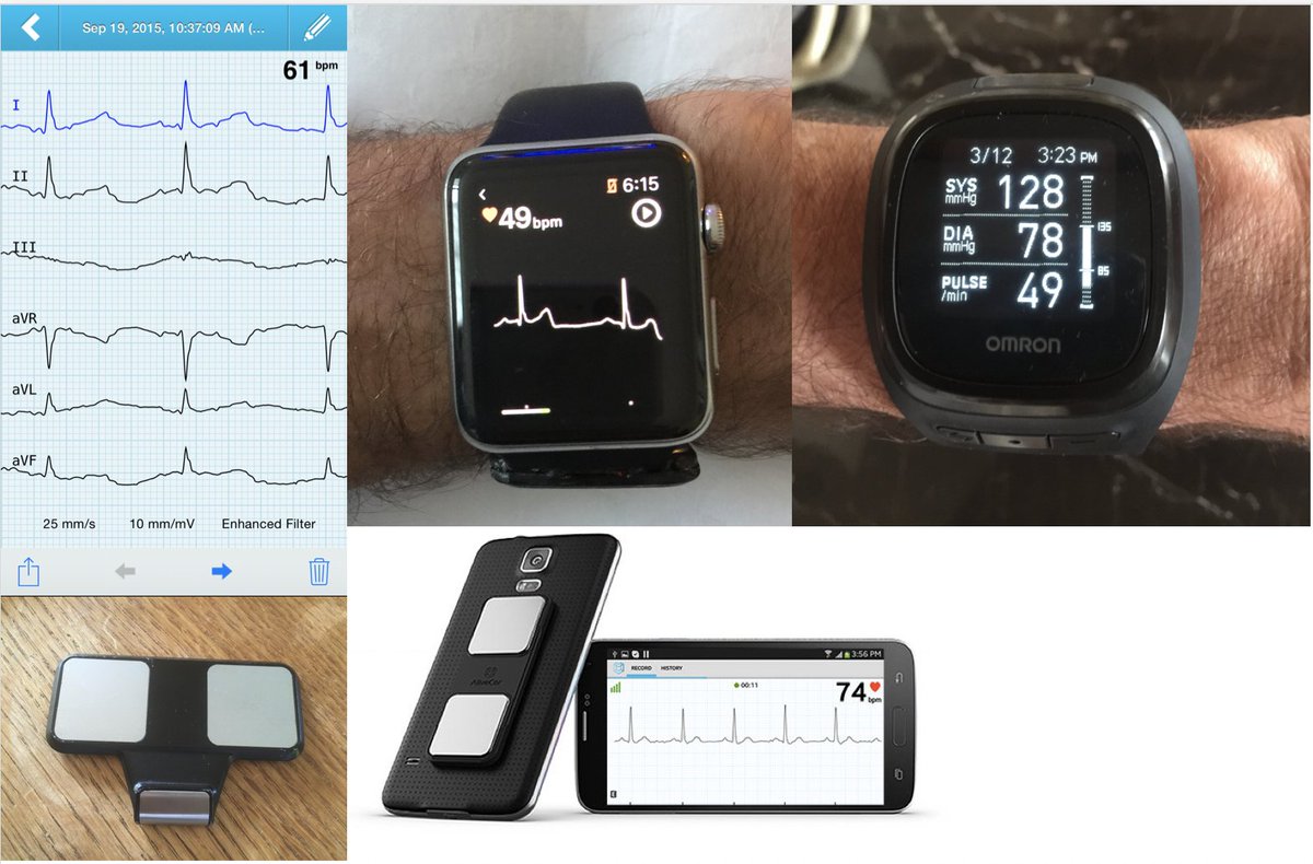 Combining smartphone ECG, blood pressure &amp; artificial intelligence to help prevent stroke techcrunch.com/2017/03/16/ali… <a href="/TechCrunch/">TechCrunch</a> <a href="/sarahbuhr/">Sarah Buhr Davis</a> #AI