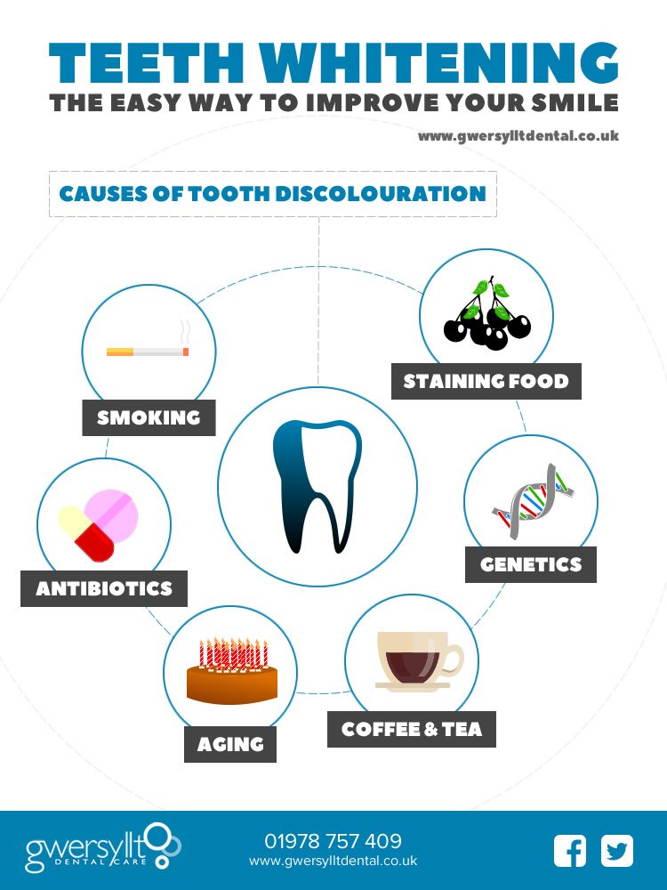 dentistwrexham's tweet photo. Teeth Whitening - The easy way to improve your smile - https://t.co/1AmaeTsN3V https://t.co/QzsKbKOxFZ