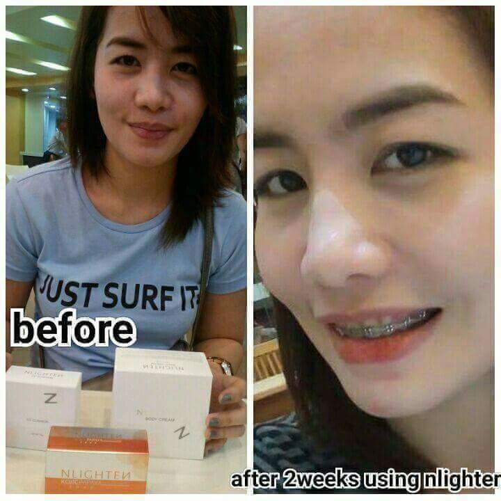 Be eNlightened with high-end beauty products from Korea and Earn !
#startyourownbusinessnow 
#earnfromhome 
For more info:
+639182628770