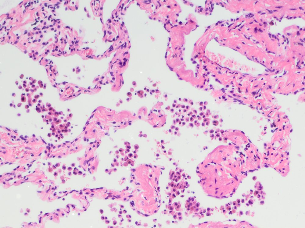 Ignacio Aranda PhD tweet media