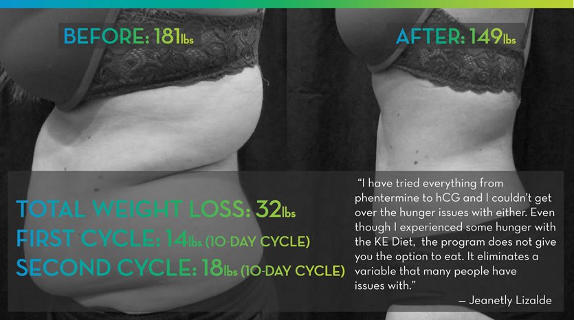 bmmwlc_pc's tweet photo. The #KE #diet works. #Lose fat.  Our recent patient lost 17 pounds in 10 days.  Free #demo &amp; seminar on 3/20 at 6 pm.  Call 1-844-695-4331 https://t.co/MNfrKJowfE