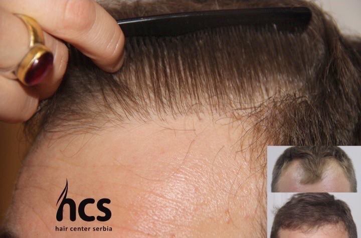 Hair Center Serbia on Twitter: Hair Center Serbia on Twitter: