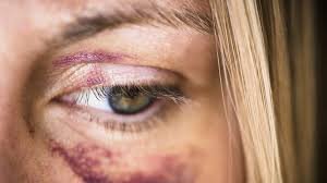 #TresPalabrasQueDanMiedo
"Pero me quiere"
"No pasará más"
"Es el alcohol"
"Mejor no denuncio"
"Es culpa mia"