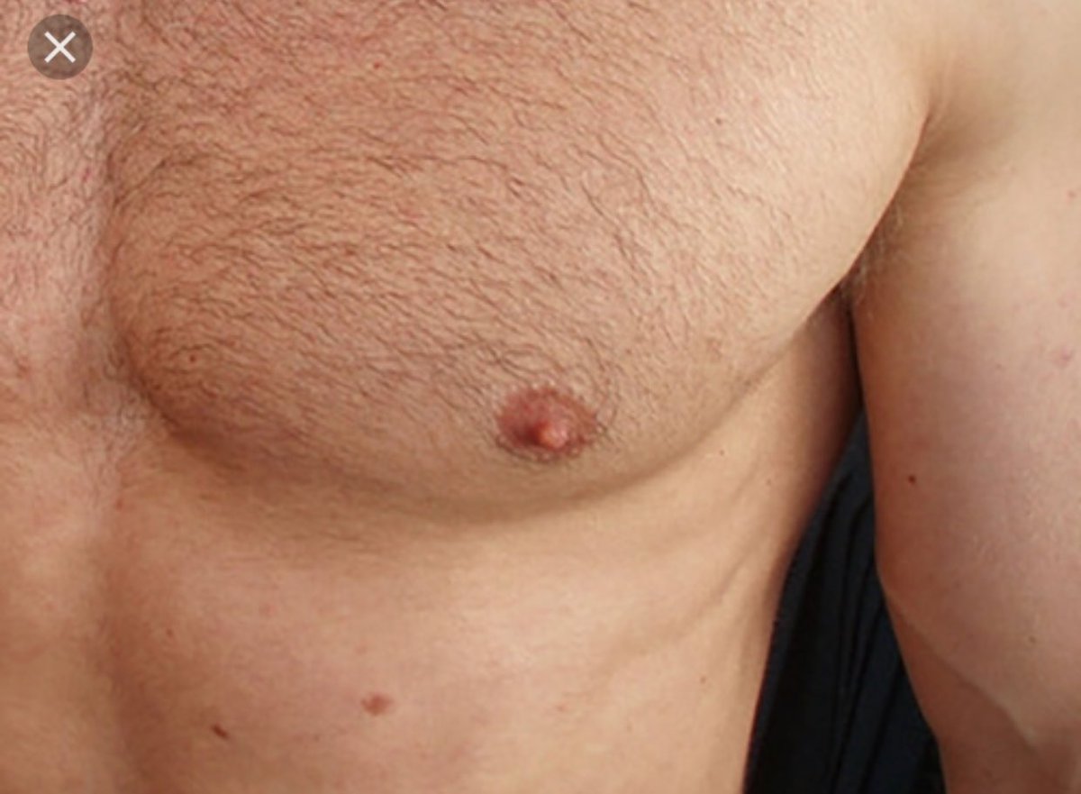 черные точки на груди у мужчин фото 85