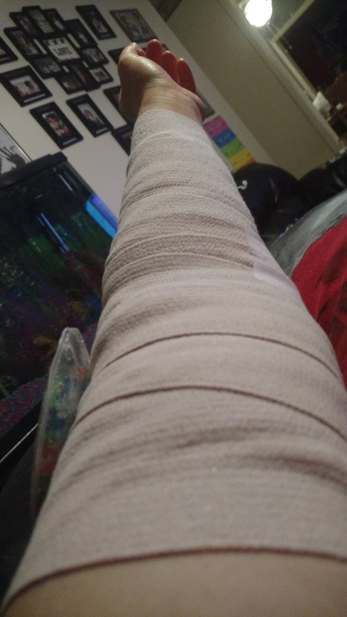 My new bandage for next few weeks 😑
Surgery went good though 😇