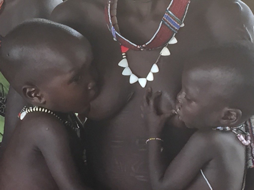 alextomo's tweet photo. Natural life support in S Sudan can be lethally weak when mothers become sick https://t.co/5laxHsZwMe