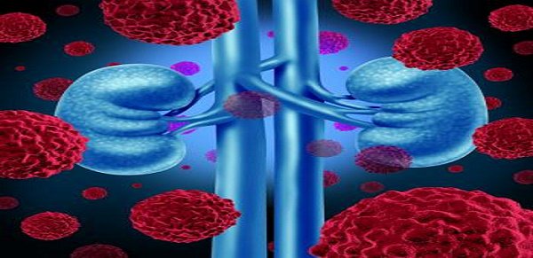 clinical_th's tweet photo. #sweden #clinical #conferences: Investigational #drug shows promise for hard-to-treat #renal #cancer https://t.co/Hae1DgcpNg https://t.co/bmyecS9zyI