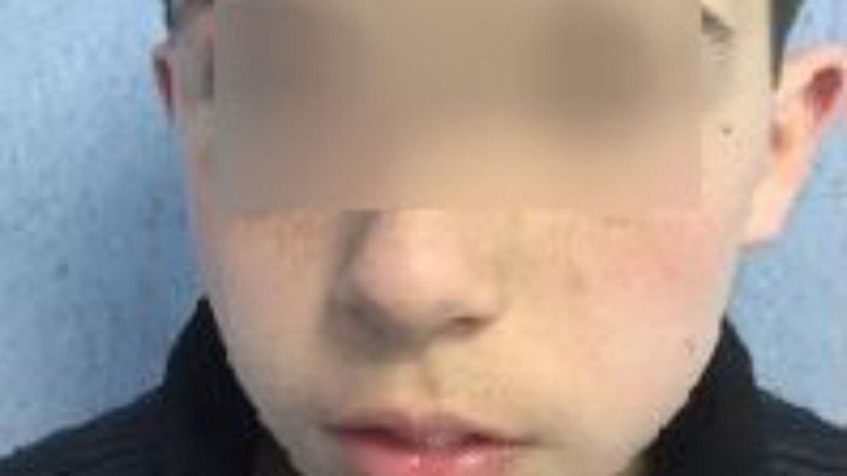 MediasetTgcom24's tweet photo. Aggredito da bulli, genitori pubblicano una foto shock su Facebook #Napoli https://t.co/6LaJXA5yY0 https://t.co/y0YWZEkTuo