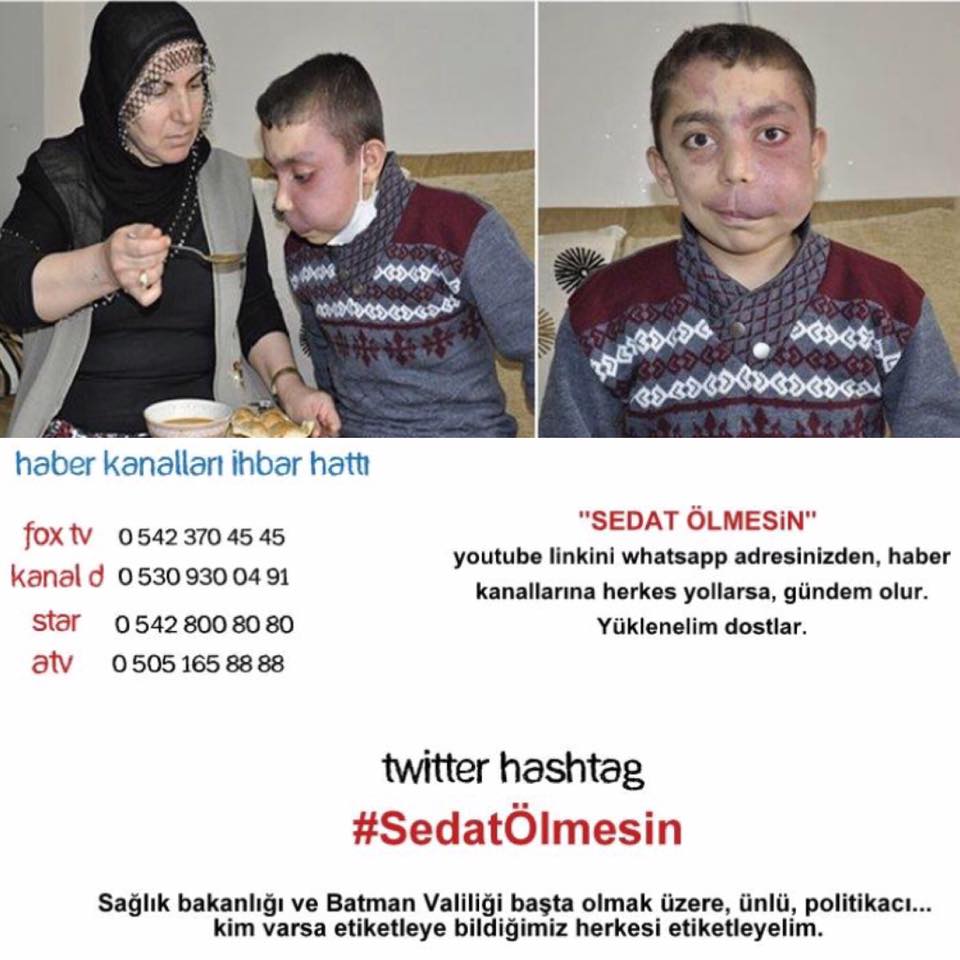 Alikayar1903's tweet photo. Aile İletişim: 0553 020 50 57 #SedatÖlmesin
https://t.co/71rrUcbz6V
@siring @Sabah @beyazshow @beyaztvcomtr @CMYLMZ @RT_Erdogan @milliyet https://t.co/rU5CXivZZy