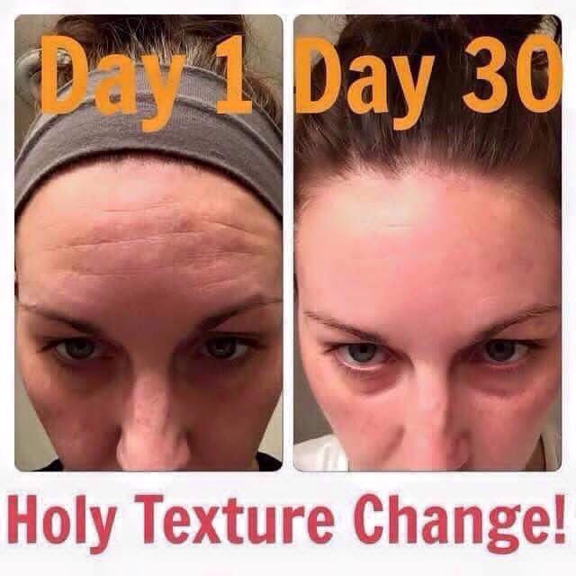 lauriesynchro's tweet photo. One of the first things you notice is the amazing texture change! 💖💖💖💖 #rodanandfields #SkinBeautiful #ShineOn https://t.co/5BwOID7uKR