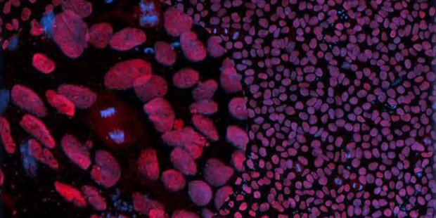 RespiratoryRes's tweet photo. Antibody Therapy Targets Cancer Stem Cells @ScienceTM https://t.co/tJEFAqWRnr https://t.co/GFEJo9y35e