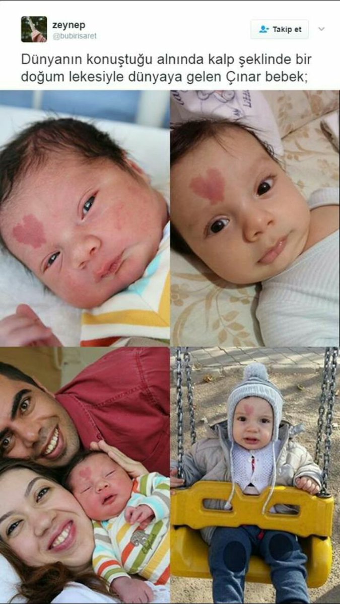 Alnında kalp resmiyle dünyaya gelen romantik bebek