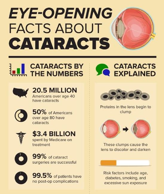 PEACHTREE_study's tweet photo. Cataracts are one potential sight-threatening complication of uveitis. https://t.co/g3arRvnKEF