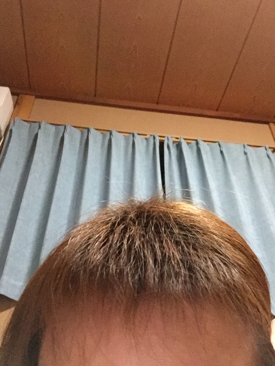 Chau サラコナーになりたい 産後の抜け毛 その後 抜けるのは落ち着いた 1枚目は前髪を撫で付けてブラシでポンポン叩くと短い毛が出てきた状態 2枚目は前髪おろしたとき 1枚目の状態ひどいよ ベリーショートのババアって感じで むしろ