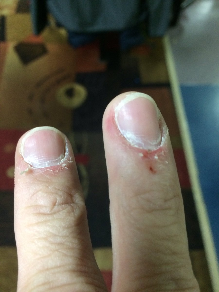 SmilingBowler's tweet image. Have fun.. roll the rock.. feel good and stay happy. #KeepSmiling #TheDutchmanBaloneyTourney #KickAssAndSmile Woot Woot! (: .)