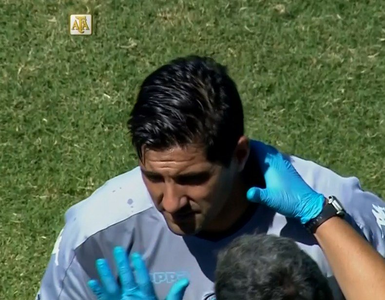 SC_ESPN's tweet photo. Cayó una bomba de estruendos en la previa de Belgrano vs. Racing: a Orión se le inflamó el pómulo y está con hielo. https://t.co/jYKL7fHuQd