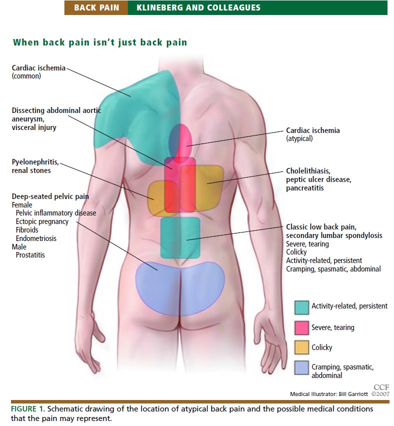 Dr Amanda J Meyer Pronounced M R On Twitter The Importance Of Learning Visceral Referred Pain Chi255 Masquerade Medical Causes Of Back Pain Pubmed Ncbi Https T Co I0jdcal9z5 Https T Co Rhu0izjkdg