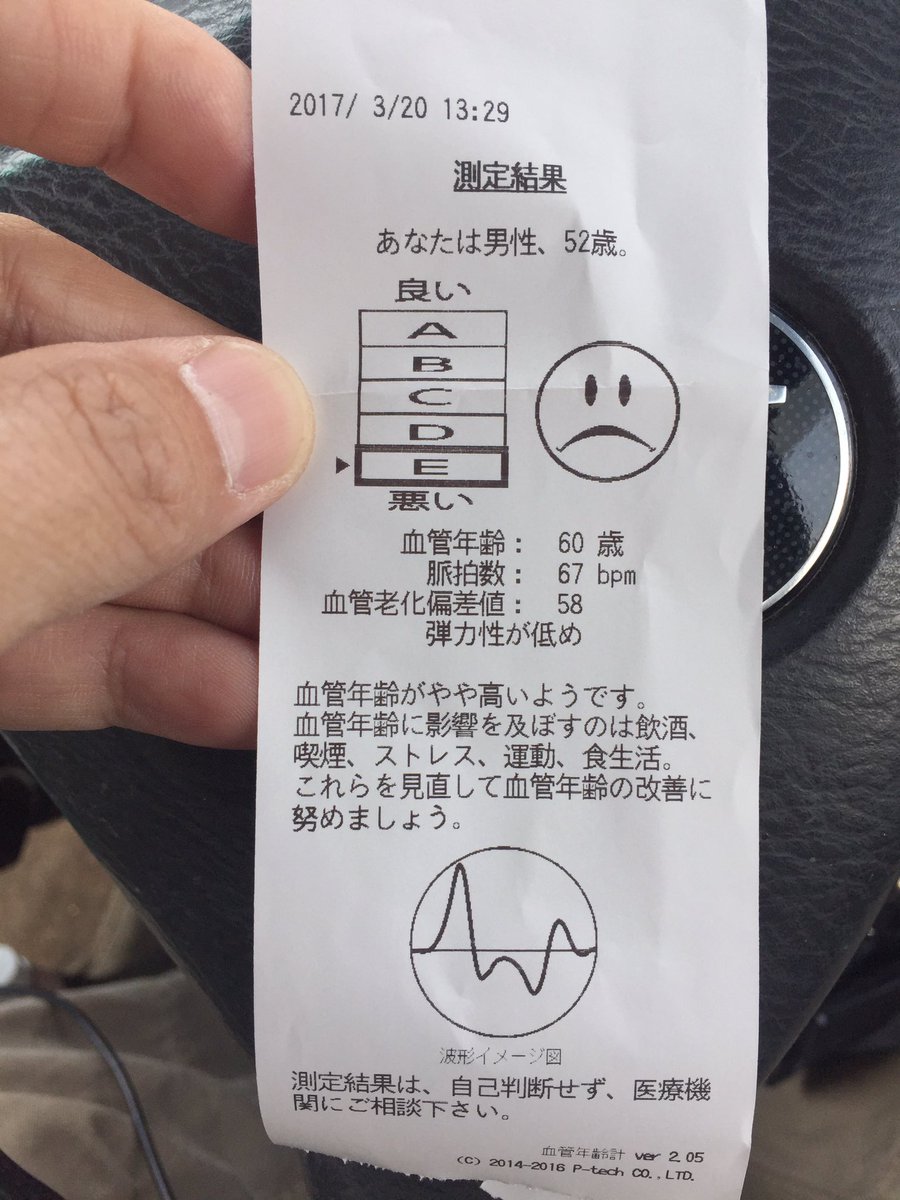 じぇ 昔ながらの Twitter પર 血管年齢を測る機械にかかったら eだって プツッて 逝っちゃうタイプなんだよ 見直さなきゃ 皆んなもやってみて スギ薬局にあるから じぇ 昔ながらの Twitter પર 血管年齢を測る機械にかかったら eだって プツッて 逝っちゃうタイプなんだよ 見直さなきゃ 皆んなもやってみて スギ薬局にあるから