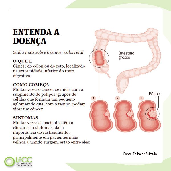 LigaFCC's tweet photo. Incidência de #câncer #colorretal aumenta entre os mais jovens. Conheça e previna-se! https://t.co/Gqmm1NNPap