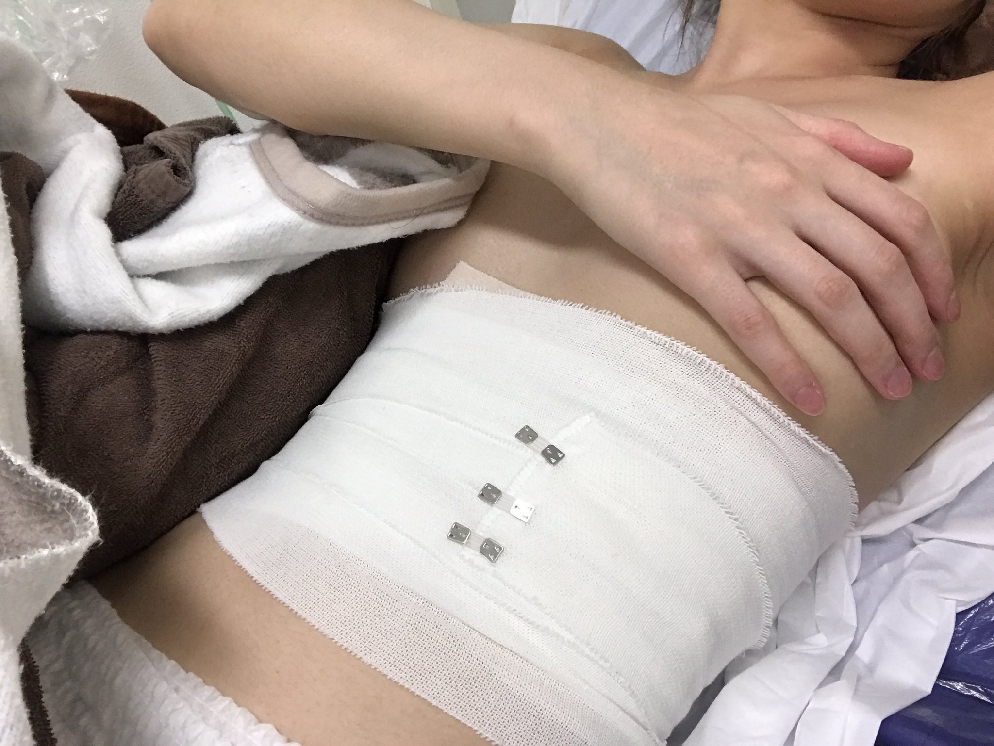 姫野さくら 肋骨3本抜きました 今日退院しました 肺が苦しいけど何とか生きてる 姫野さくら ハイブリッドバンク所属 北新地チェリーブロッサム 美容整形 モデル キャバ嬢 北新地 肋骨除去 しらゆりビューティークリニック T Co 姫野さくら 肋骨3本抜きました 今日退院しました 肺が苦しいけど何とか生きてる 姫野さくら ハイブリッドバンク所属 北新地チェリーブロッサム 美容整形 モデル キャバ嬢 北新地 肋骨除去 しらゆりビューティークリニック T Co