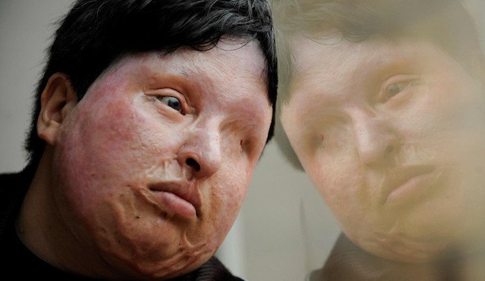 MSLMNJ's tweet image. Iran: Alarming rise in acid attacks against women who are not properly veiled: Women who are not properly veiled:… m.tbnn.it/NgjBwt