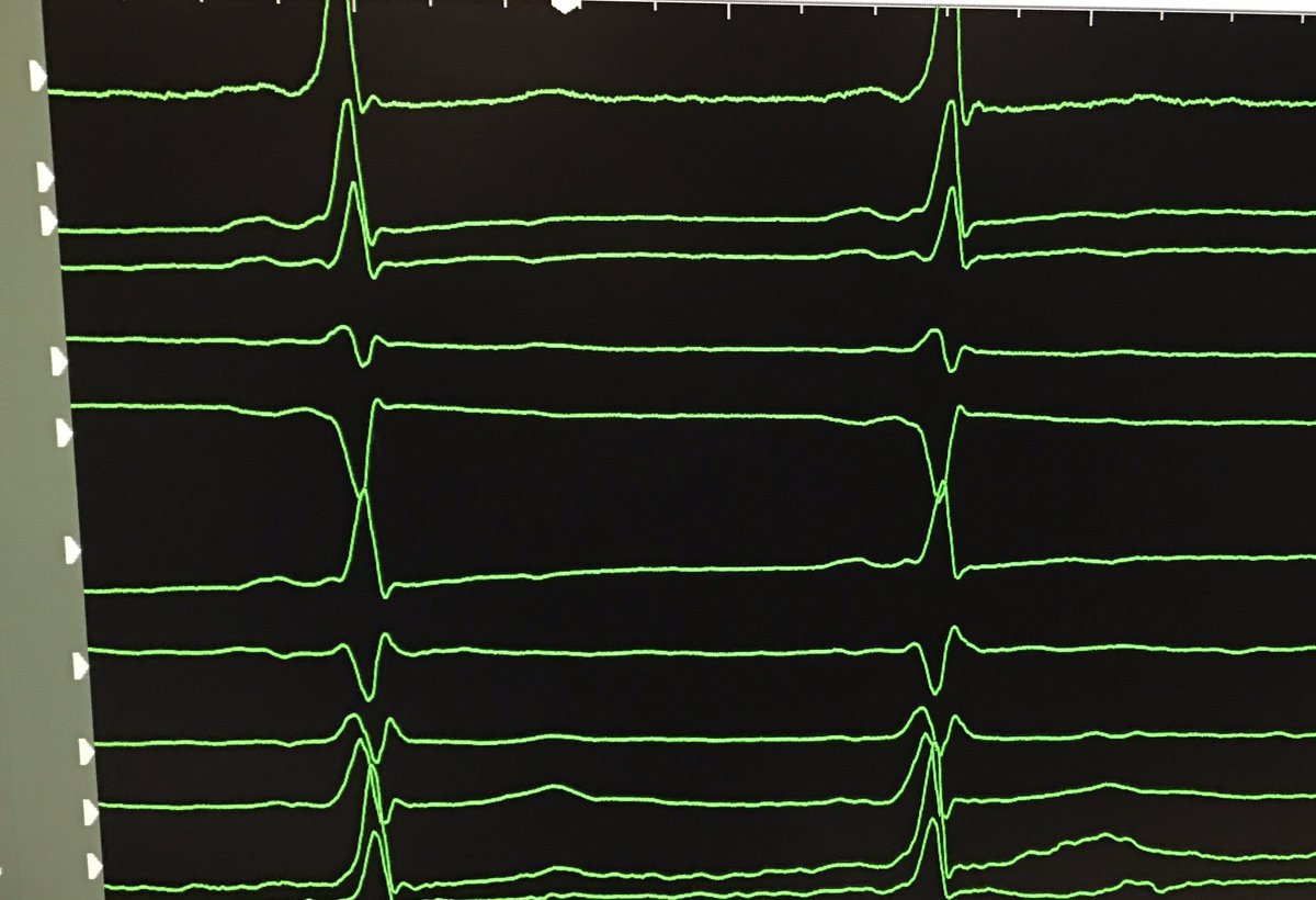 atypicalflutter's tweet image. Where is the Kent?