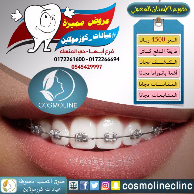 كوزمولاين On Twitter عروض عيادات عيادات كوزمولاين عروض مميزة اسنان تقويم تقويم اسنان معدني أبها حي المنسك للتواصل 0172261600 0172266694 0545429997 Https T Co Ghyqpqrc16