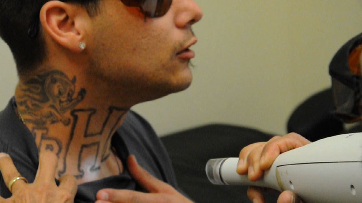 Deportation fears lead many to opt for #tattoo removal bit.ly/2n1qNx4 https://t.co/HVXxLLwx3v