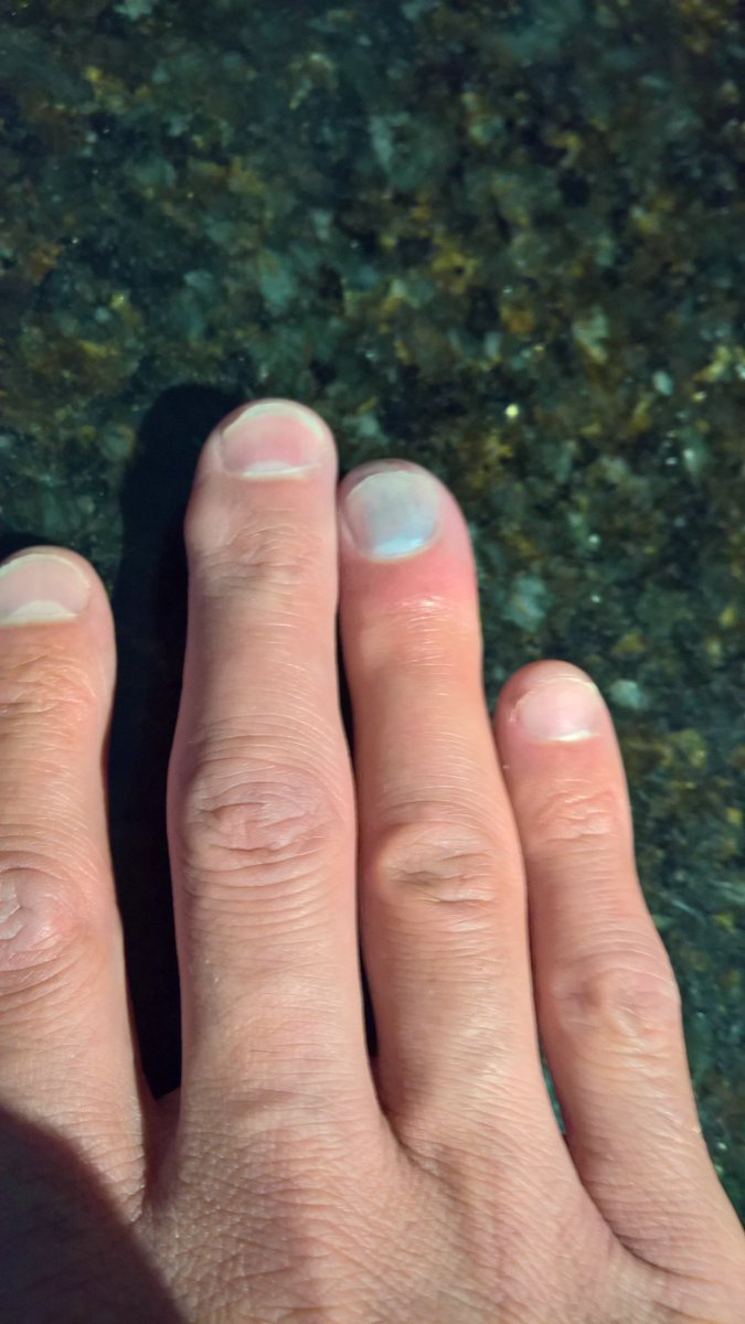 überlaufen Ausschließen Fehler puss ball 鍔 intellektuell Katastrophe