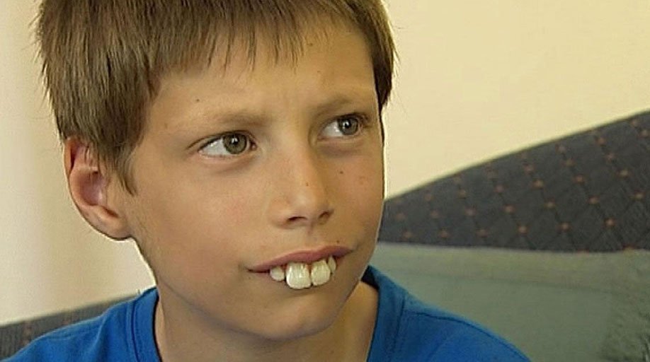 Bullied buck-toothed kid finally gets his perfect smile. pic.twitter.com/hr...