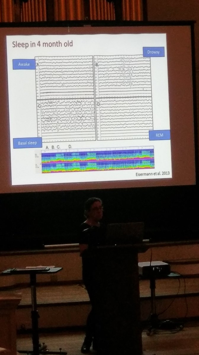 AdrianTearle's tweet photo. @ClinNeurophys @BscnWadham sleep patterns in a 4/12 old baby https://t.co/yrj0JbdJpw