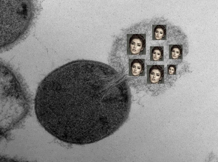 rubenvlza's tweet photo. Dr. Ang: Pag nag-lyse yung cell, ano ang lalabas?
Me: Lysa Soberano?
#celllysis @lizasoberano #renalpamore @maartistmd https://t.co/4bOPqKP0yn
