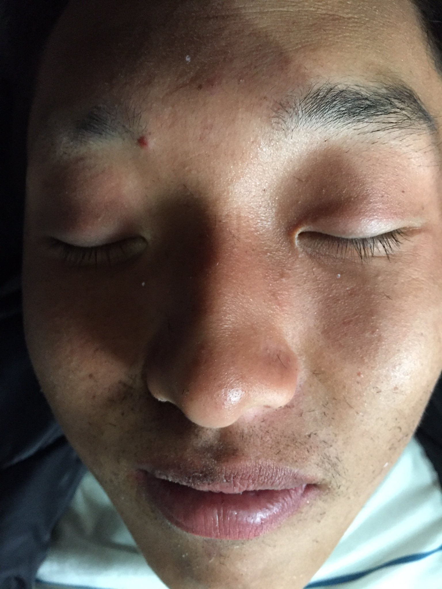 中山 裕隆 眉毛剃るの失敗して ヒゲ剃るのも失敗した 口の周り毛まみれ爆笑 笑いすぎてやばい 木村侑生 T Co 0ksmghaavt Twitter