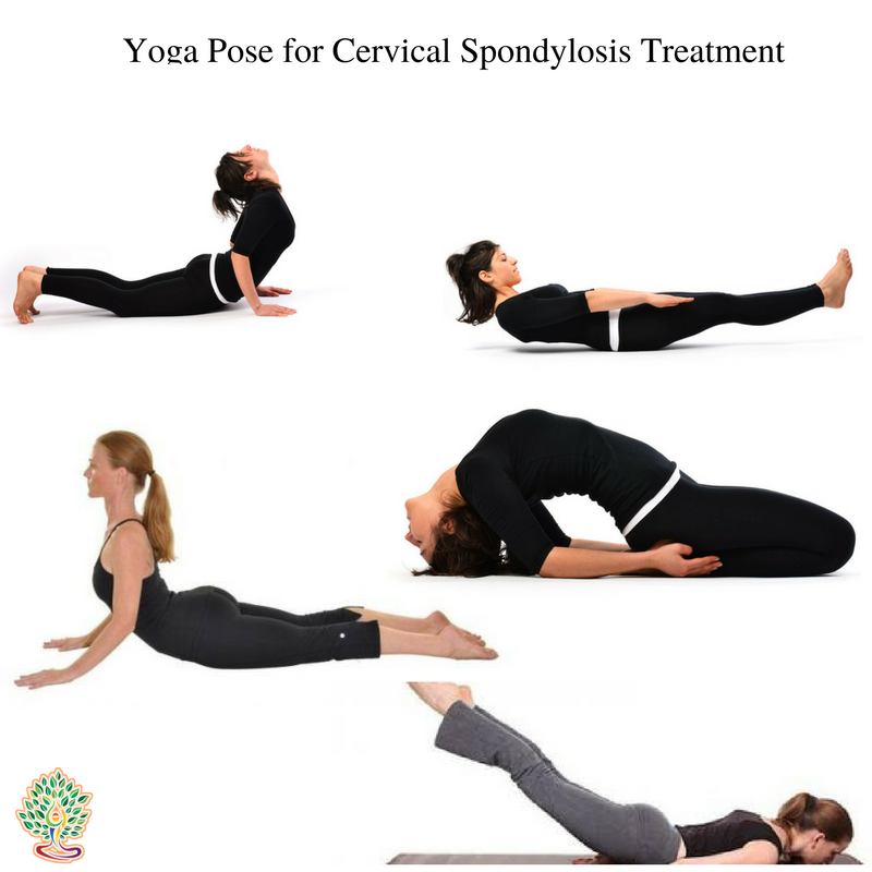 Cervical Spondylosis Yoga Exercises