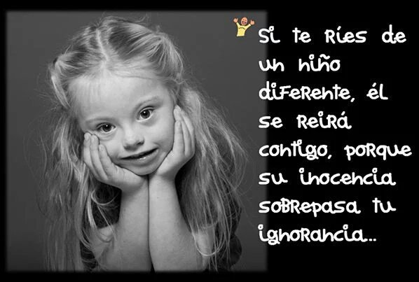 ¿Que nos diferencia de ellos?
Solo un cromosoma.
Aceptar la diversidad, es aceptarnos a nosotros mismos
#SindromeDeDown