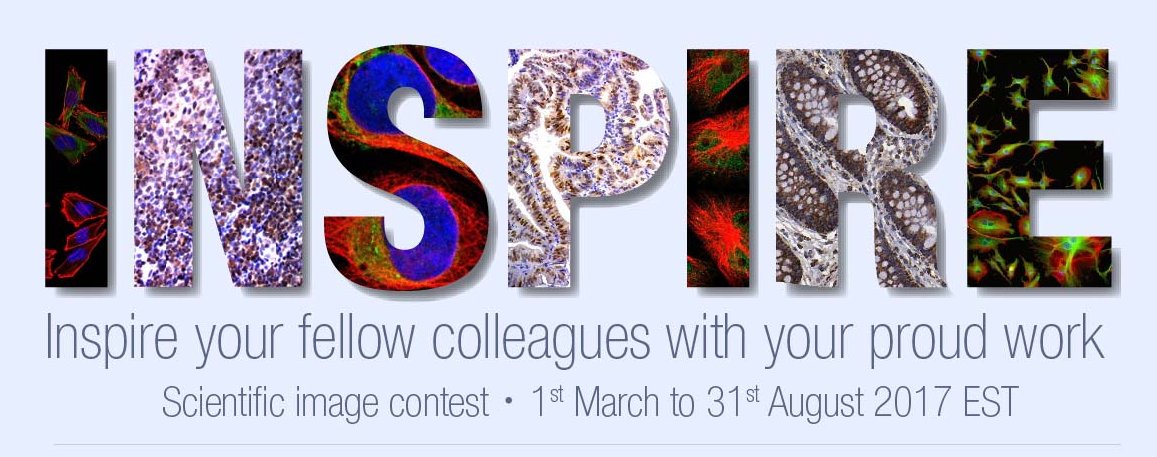 Abnova1's tweet photo. #Abnova Scientific Image Contest. Earn 50 USD #GiftVoucher plus a chance to win a complete set of #AmazonEchoFamily! https://t.co/XgeoFm7K2j https://t.co/9Ed8sRnElp