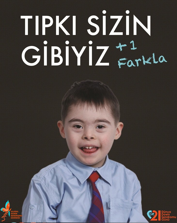 #DownSendromu Bu çocuklar hepimizin ,onları çok seviyorum.