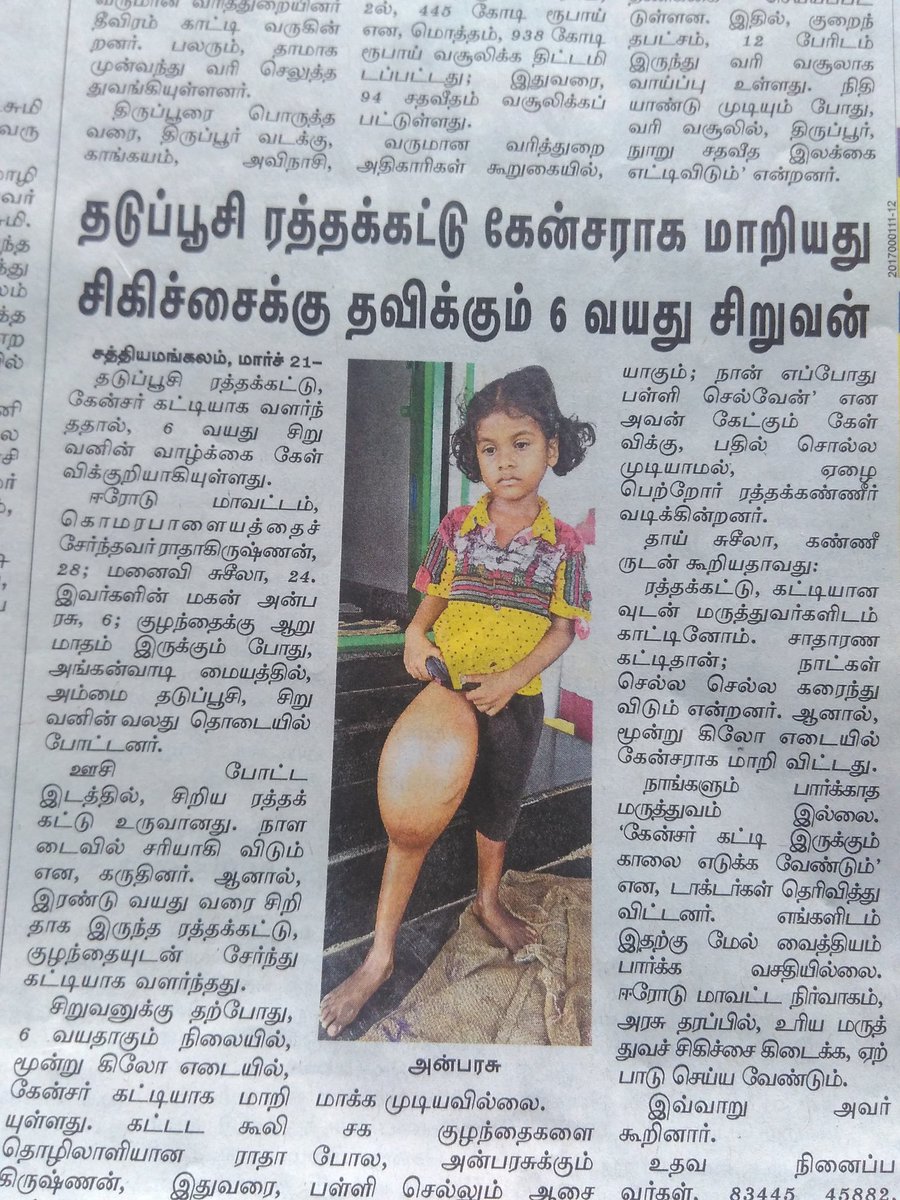 imparattai's tweet photo. அரசோ அல்லது தனியார் அறக்கட்டளை அமைப்புகளோ இச்சிறுவனுக்கு உதவி உயிர்காக்கலாமே? தயவுசெய்து பகிரவும். பரிதாபத்திற்கு தீர்வுகிடைக்கட்டும். https://t.co/wzbpALcQs8